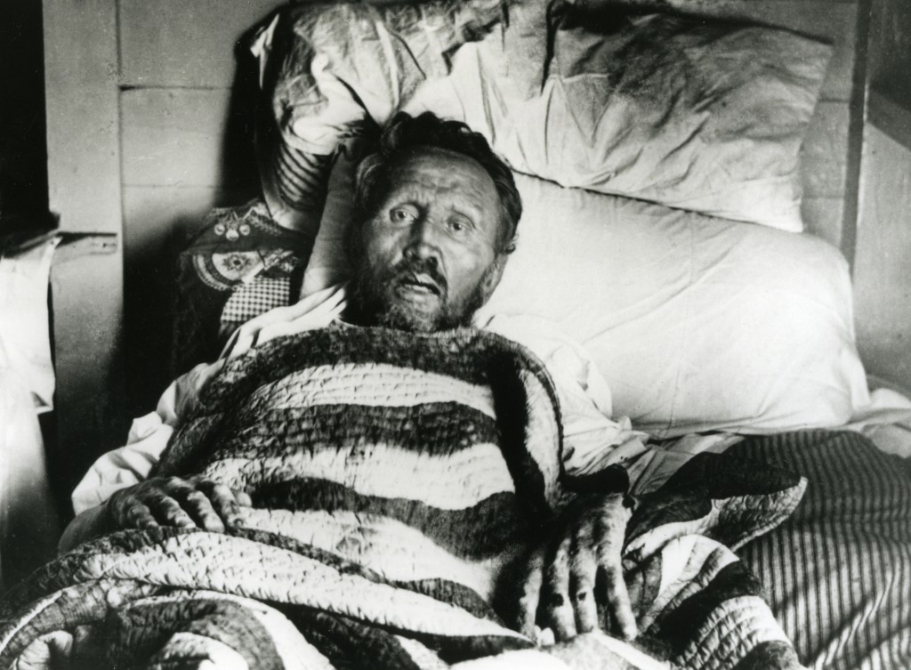 Saint Damien de Veuster in bed shortly before he died in 1889 at the Kalawao settlement on the Hawaiian island of Molokai. PHOTO: CNS