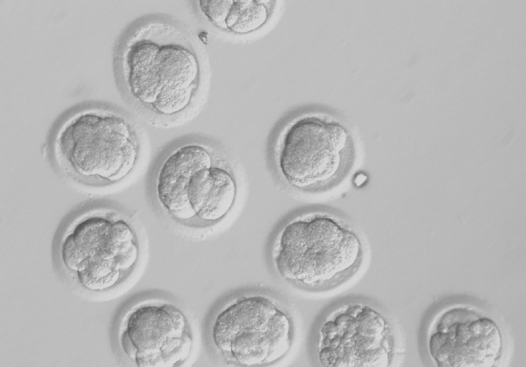 Human embryos created by somatic cell nuclear transfer are pictured on the third day of development in experiments conducted by researchers in Oregon. PHOTO: CNS/courtesy of Oregon Health & Science University