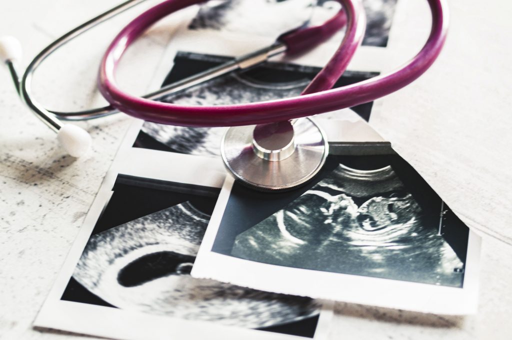 Under the proposed NSW law, abortion would be legalised on request for women up to 22 weeks pregnant if the procedure is performed by a registered doctor. Photo: Adobe Stock.
